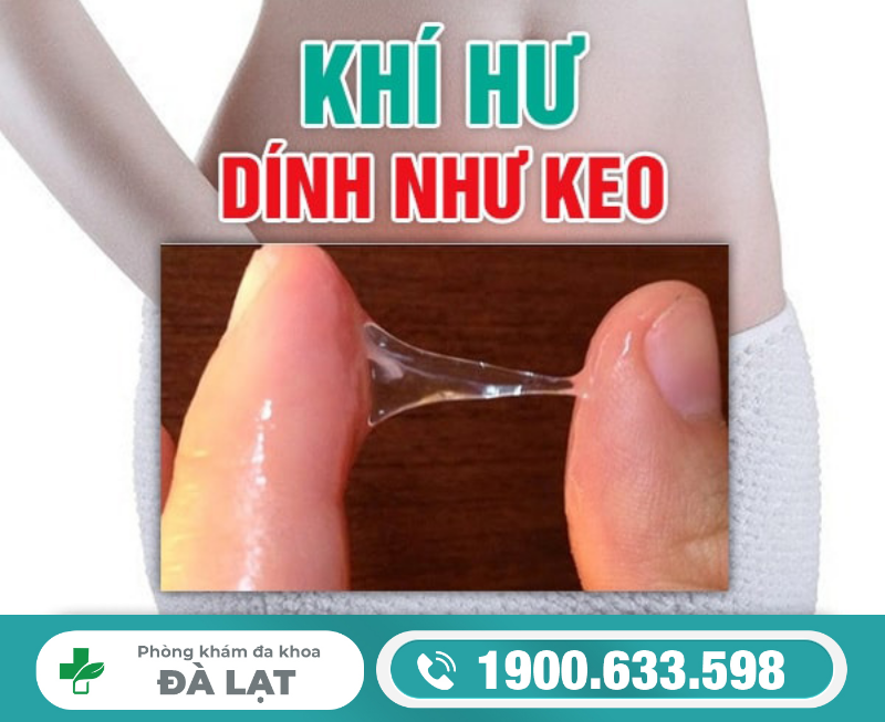 Hình ảnh minh họa